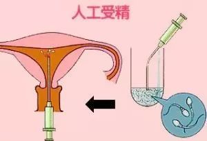 不孕不育