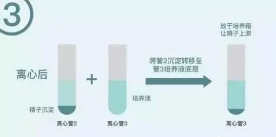 女性不孕症