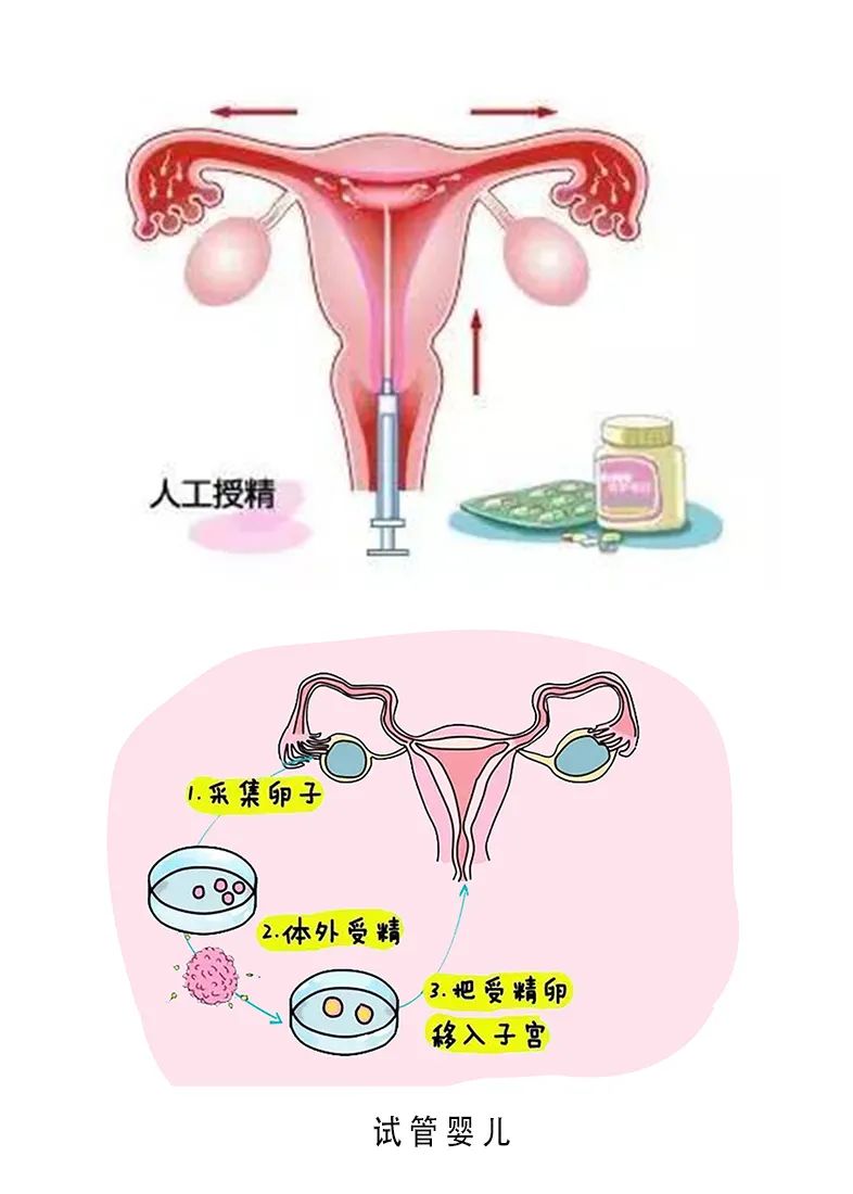 女不孕不育