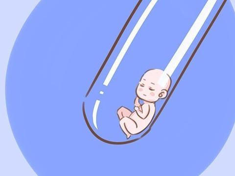 人工授精