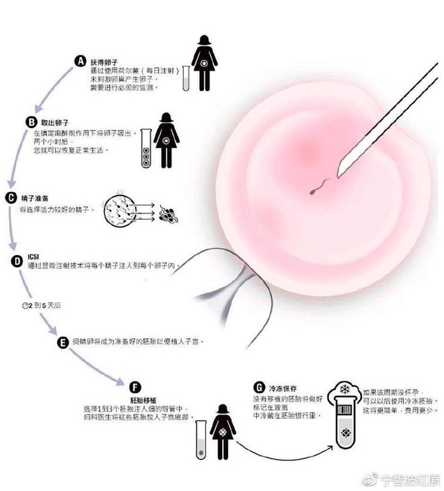 人工授精